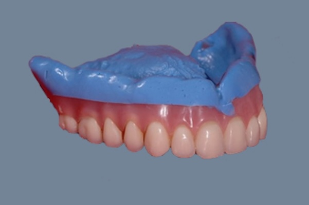 denture reline