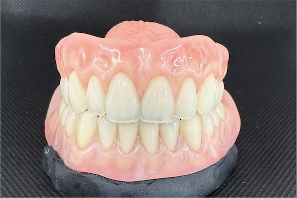 full denture